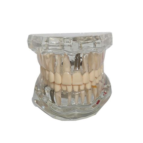 3D model ľudského chrupu