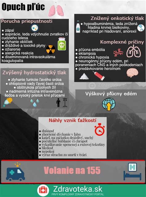 Infografika: Hlavné príčiny opuchu nôh