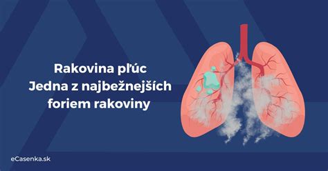 Porovnanie rizík vzniku pľúcneho infarktu