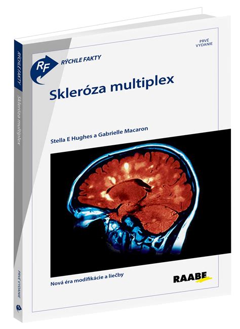 Staroveké zobrazenie liečby magnetmi