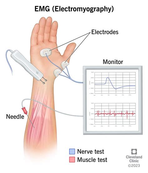 Schéma EMG biofeedback prístroja