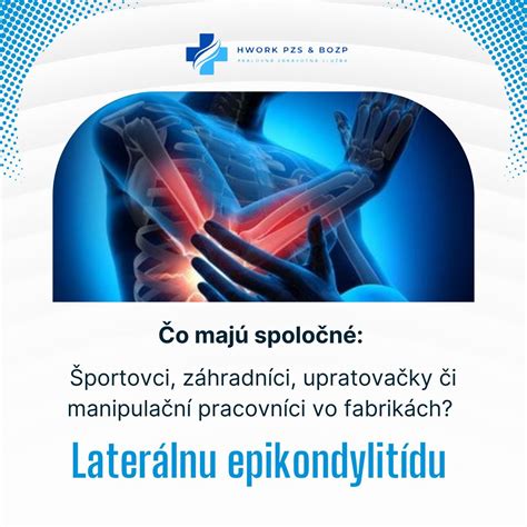 Bolesť pri tenisovom lakti