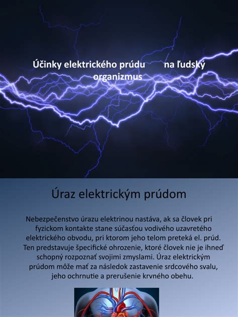 Schéma pôsobenia elektroliečby na ľudský organizmus
