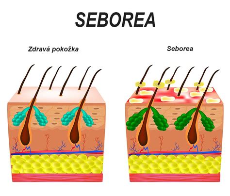 Porovnanie zdravej a starnúcej pokožky
