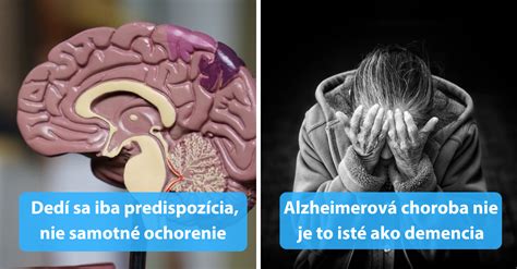 Infografika o Alzheimerovej chorobe a jej príznakoch