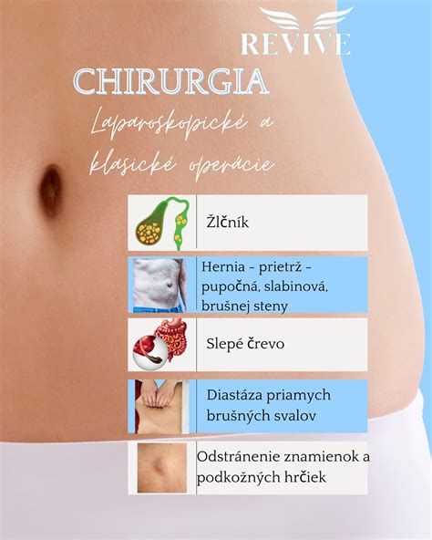 Nákres rôznych typov hernií (slabinová, pupočná, jazvová)
