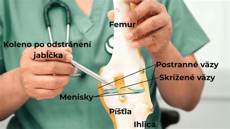 Platby Medicare za endoprotézu kolena a vývoj nákladov