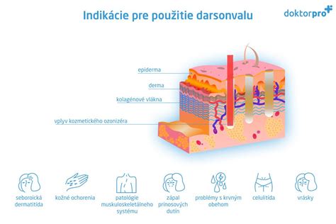 Indikácie pre fyzioterapiu