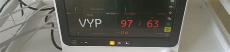 Monitorovanie vitálnych funkcií u pacienta po operácii