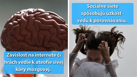 Schéma rôznych typov demencie a ich vplyv na mozog