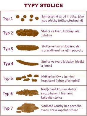 Rozdielne typy detskej stolice