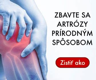 Aplikácia ľadu na opuchnuté koleno