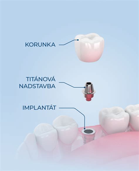 Mechanizmus fungovania penis extendera