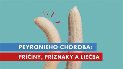 Peyronieho choroba - znázornenie zakrivenia penisu