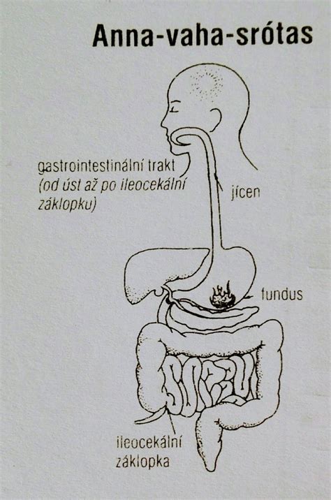 Schéma tráviaceho systému s vyznačeným tenkým a hrubým črevom