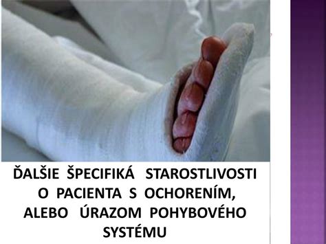 Pacient so sadrovým obväzom