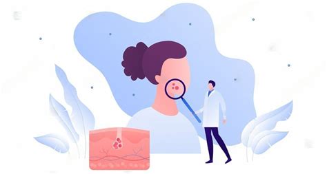 Ilustrácia rôznych kožných ochorení
