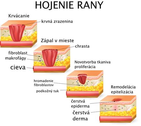 Hojenie rany po operácii