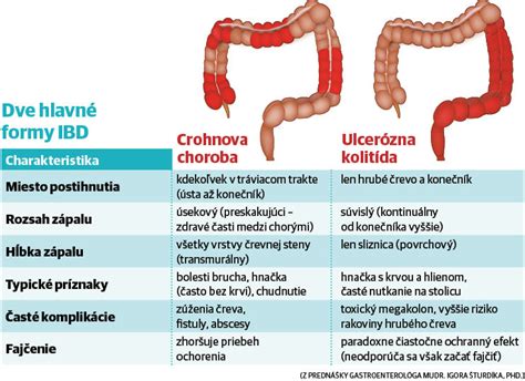 Zápalové ochorenia čriev (IBD)