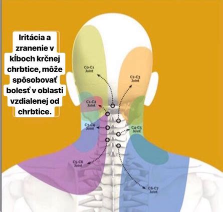 Diagnostika a liečba bolesti krčnej chrbtice