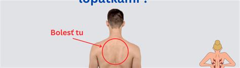 Schéma bolestivých oblastí medzi lopatkami