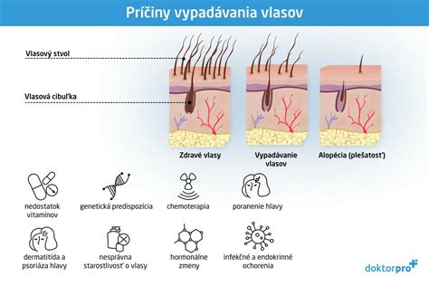 Príčiny poškodenia vlasov