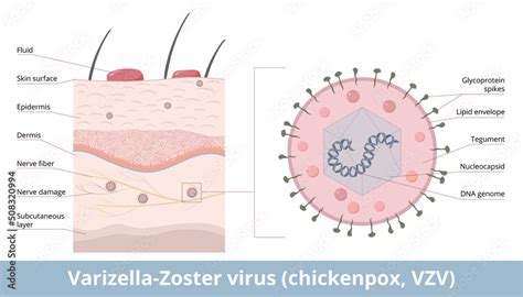 Schéma: Prepojenie vírusu varicella zoster s ovčími kiahňami a pásovým oparom