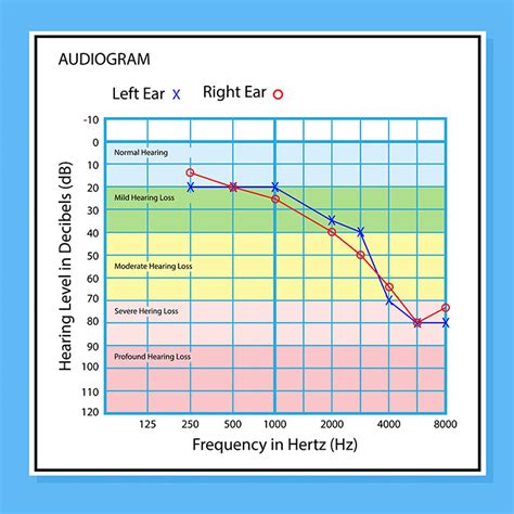 Audiogram s výsledkami testu sluchu