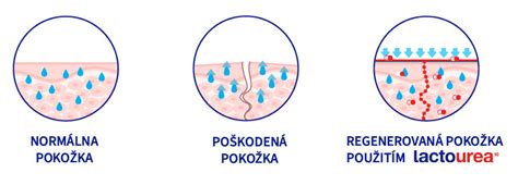 Zobrazenie suchej a normálnej pokožky