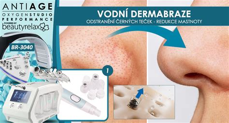 Dermatologické ošetrenie suchej pokožky
