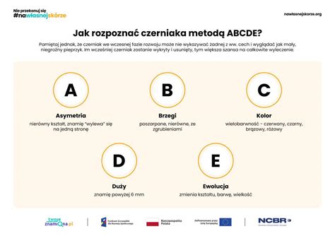 Infografika: Systém ABCDE pre samovyšetrenie znamienok