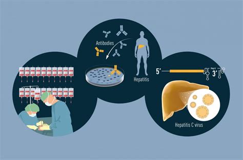 Infografika o prenose hepatitídy A a B