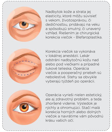 Schéma tejpovania očných viečok pre rôzne problémy