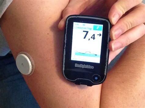 Diabetik používajúci glukózový senzor