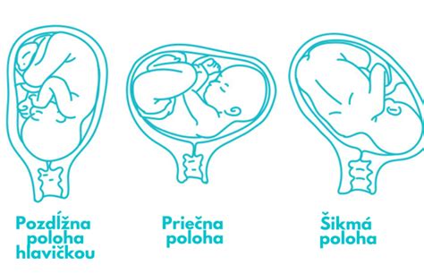 Schéma vyvíjajúceho sa plodu v maternici