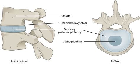 Artróza chrbtice a jej vplyv na medzistavcové platničky