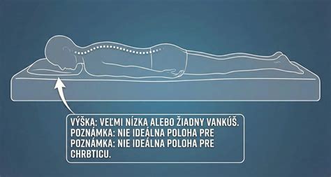 Schéma umiestnenia stómie na bruchu