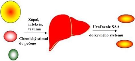 Schéma progresie HIV infekcie od akútnej fázy po AIDS