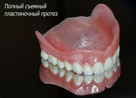 Fotografie rôznych typov protéz (privykacia, definitívna, silikónová, štítová)