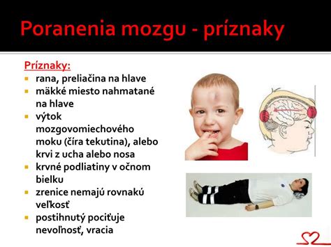 Príznaky traumatického poranenia mozgu