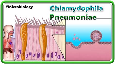 Schéma vplyvu Chlamydia pneumoniae na rôzne orgány