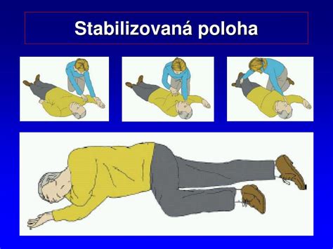 Stabilizovaná poloha pre bezvedomého dospelého