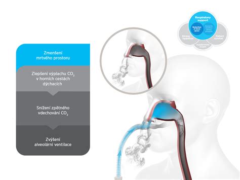 anatomické umiestnenie laryngeálnej masky v dýchacích cestách