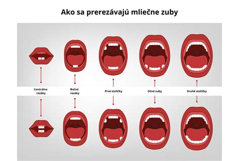 Príčiny predčasného prerezávania trvalých zubov