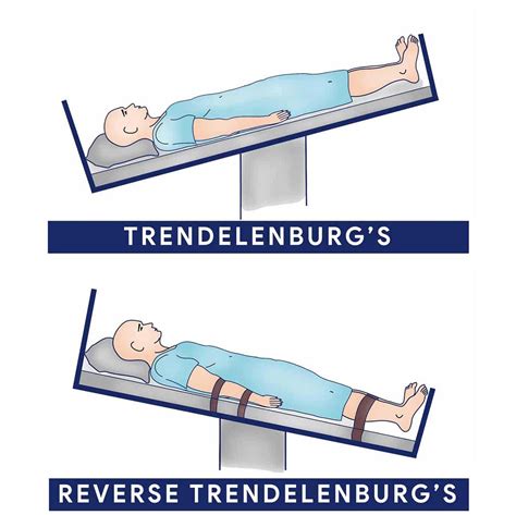Schéma polôh Trendelenburg a Anti-Trendelenburg