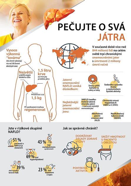 Infografika: Prehľad odvodov SVA