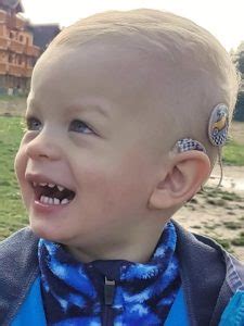 Načúvací prístroj a kochleárny implantát