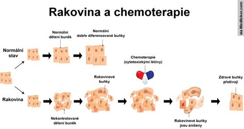 Schéma účinku chemoterapie na nádorové bunky
