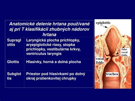 Schéma tracheostómie s vyznačenými časťami krku a priedušnice