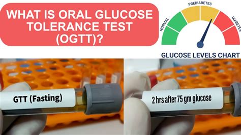 Schéma glukózo-tolerančného testu (OGTT)